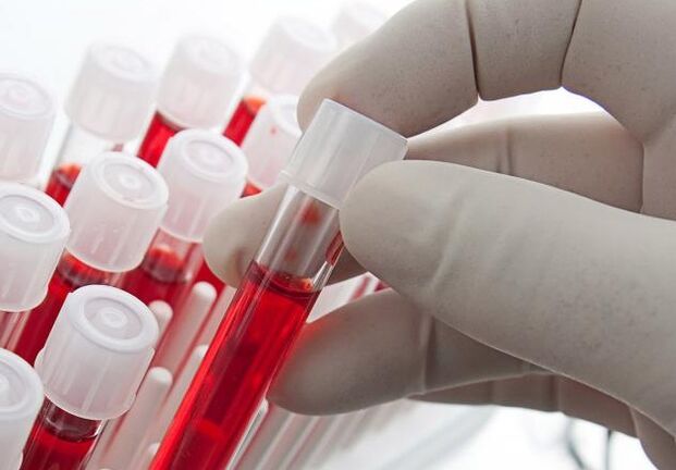 vérvizsgálat alkoholfogyasztás után